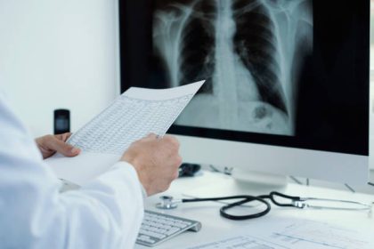 Messina chemioterapia intra-toracica innovativa
